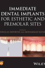 Immediate Dental Implants for Esthetic and Premolar Sites af Douglas (University of Toronto Deporter