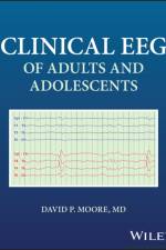 Clinical EEG of Adults and Adolescents af David P. (University of Louisville School of Medicine Moore