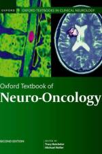 Oxford Textbook of Neuro-Oncology