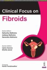 Clinical Focus on Fibroids af Neharika Malhotra