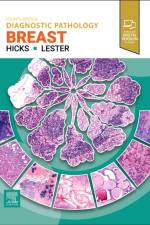 Diagnostic Pathology: Breast af Susan C. (Former Chief of Breast Pathology Services Lester