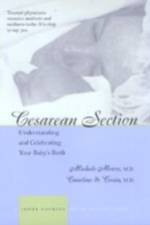 Cesarean Section: Understanding and Celebrating Your Baby's Birth af Michele C. Moore