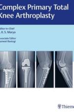 Complex Primary Total Knee Arthroplasty