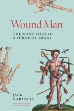 Wound Man af Jack Hartnell