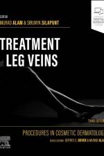 Procedures in Cosmetic Dermatology Series: Treatment of Leg Veins
