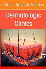 Artificial Intelligence in Dermatology, An Issue of Dermatologic Clinics