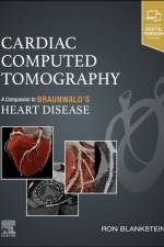 Cardiac Computed Tomography