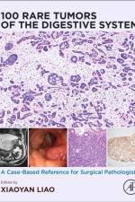 100 Rare Tumors of the Digestive System