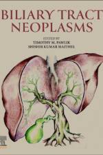 Biliary Tract Neoplasms