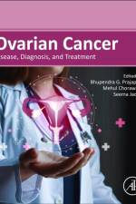 Ovarian Cancer