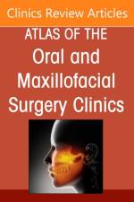 Implant Solutions for Complex Cases: Graftless Solutions, An Issue of Atlas of the Oral & Maxillofacial Surgery Clinics