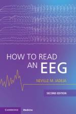How to Read an EEG af Neville M. (UMass Chan Medical School) Jadeja