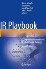 IR Playbook
