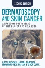 Dermatoscopy and Skin Cancer, second edition af Cliff Rosendahl