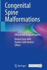 Congenital Spine Malformations