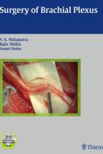 Surgery of Brachial Plexus