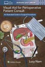 Visual Aid for Perioperative Patient Consult af Lucy Nam