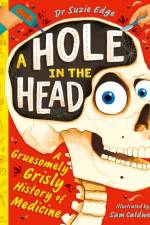 A Hole in the Head af Suzie Edge