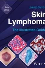 Skin Lymphoma af Lorenzo (Medical University of Graz Cerroni