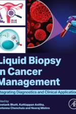 Liquid biopsy in Cancer Management