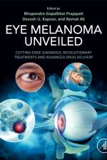 Eye Melanoma Unveiled