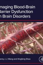 Imaging Blood-Brain Barrier Dysfunction in Brain Disorders af Danny J.J. Wang