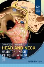 Diagnostic Imaging: Head and Neck af Bronwyn E. (Professor of Radiology Hamilton