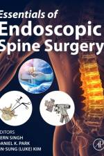 Essentials of Endoscopic Spine Surgery