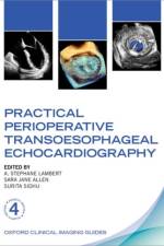 Practical Perioperative Transoesophageal Echocardiography