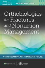 Orthobiologics for Fractures and Nonunion Management af J Tracy Watson