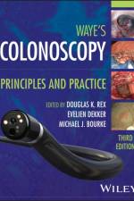 Colonoscopy