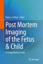 Post Mortem Imaging of the Fetus & Child