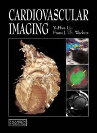 Cardiovascular Imaging av Yi-Hwa (Yale University School of Medicine Liu