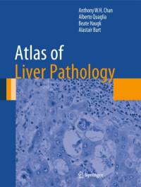 Atlas of Liver Pathology av Anthony W.H. Chan