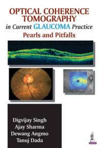 Optical Coherence Tomography in Current Glaucoma Practice av Digvijay Singh
