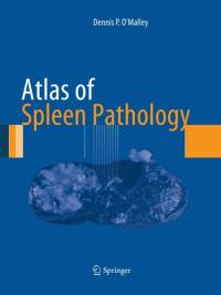 Atlas of Spleen Pathology av Dennis P. O'Malley