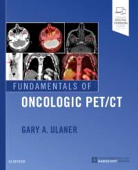 Fundamentals of Oncologic PET/CT av Gary A. (Associate Attending Radiologist Ulaner