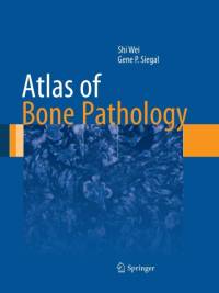 Atlas of Bone Pathology av Shi Wei