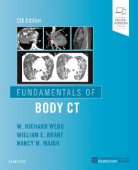 Fundamentals of Body CT av W Richard Webb