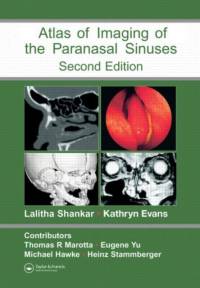 Atlas of Imaging of the Paranasal Sinuses, Second Edition av Michael Hawke