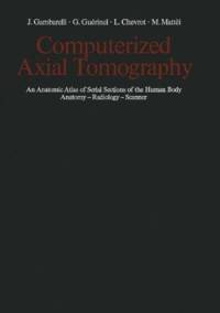 Computerized Axial Tomography av J. Gambarelli