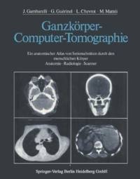 Ganzkorper-Computer-Tomographie av J. Gambarelli