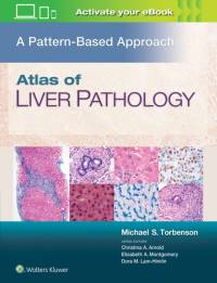Atlas of Liver Pathology: A Pattern-Based Approach av Michael Torbenson