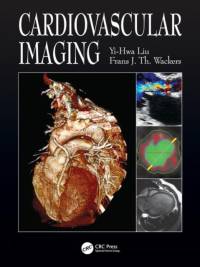 Cardiovascular Imaging av Yi-Hwa Liu