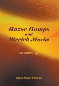 Razor Bumps and Stretch Marks av Byron Sogie-Thomas