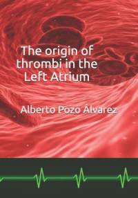 origin of thrombi in the Left Atrium av Alberto Pozo Alvarez