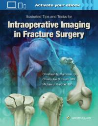 Illustrated Tips and Tricks for Intraoperative Imaging in Fracture Surgery av Michael J. Gardner