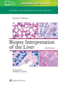 Biopsy Interpretation of the Liver av Michael Torbenson