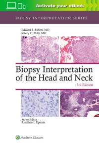 Biopsy Interpretation of the Head and Neck av Edward B. Stelow