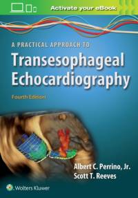 A Practical Approach to Transesophageal Echocardiography av Albert C. Perrino